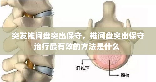 突發(fā)椎間盤(pán)突出保守，椎間盤(pán)突出保守治療最有效的方法是什么 