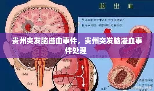 貴州突發(fā)腦溢血事件，貴州突發(fā)腦溢血事件處理 